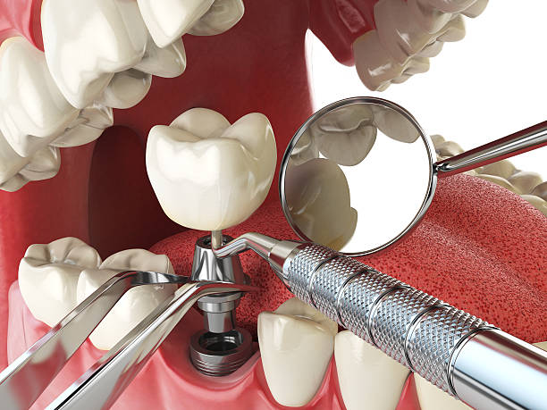 Best Emergency Dental Services for Seniors in Indian Wells, CA